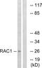 Rac Family Small GTPase 1 antibody, A03252, Boster Biological Technology, Western Blot image 