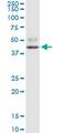 Forkhead box protein F2 antibody, MA5-18898, Invitrogen Antibodies, Western Blot image 