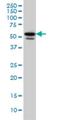Transducin Beta Like 1 X-Linked Receptor 1 antibody, H00079718-M01, Novus Biologicals, Western Blot image 