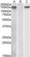 NACHT, LRR and PYD domains-containing protein 2 antibody, MBS422628, MyBioSource, Western Blot image 