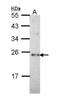 Calcineurin Like EF-Hand Protein 1 antibody, NBP2-53090, Novus Biologicals, Western Blot image 