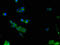 Aldolase, Fructose-Bisphosphate C antibody, LS-C500122, Lifespan Biosciences, Immunofluorescence image 