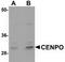 Centromere Protein O antibody, TA306853, Origene, Western Blot image 