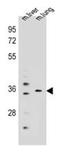 E3 ubiquitin-protein ligase TRIM13 antibody, AP52319PU-N, Origene, Western Blot image 