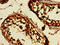 Dickkopf-like protein 1 antibody, orb39070, Biorbyt, Immunohistochemistry paraffin image 