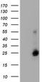 Ubiquitin Conjugating Enzyme E2 E3 antibody, TA504679, Origene, Western Blot image 