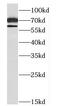 Nuclear Speckle Splicing Regulatory Protein 1 antibody, FNab01362, FineTest, Western Blot image 