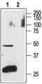 Endothelin Receptor Type A antibody, TA328803, Origene, Western Blot image 