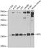 S-Phase Kinase Associated Protein 1 antibody, GTX33502, GeneTex, Western Blot image 