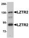 Protein transport protein Sec16B antibody, orb94365, Biorbyt, Western Blot image 
