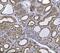 ERLIN2 antibody, M07042-1, Boster Biological Technology, Immunohistochemistry paraffin image 