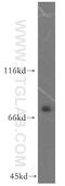 Katanin p80 WD40-containing subunit B1 antibody, 14969-1-AP, Proteintech Group, Western Blot image 