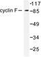 Cyclin F antibody, LS-C175987, Lifespan Biosciences, Western Blot image 