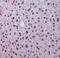 HES1 antibody, M01459, Boster Biological Technology, Immunohistochemistry paraffin image 