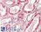 Sterol 26-hydroxylase, mitochondrial antibody, LS-B13330, Lifespan Biosciences, Immunohistochemistry paraffin image 