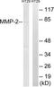 Matrix Metallopeptidase 2 antibody, TA326260, Origene, Western Blot image 