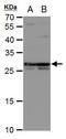 Deoxycytidine kinase antibody, PA5-21846, Invitrogen Antibodies, Western Blot image 