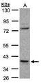 Coiled-Coil Domain Containing 68 antibody, LS-C185844, Lifespan Biosciences, Western Blot image 