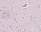 Zinc Finger Protein 536 antibody, NBP1-77092, Novus Biologicals, Immunohistochemistry paraffin image 