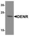 Density Regulated Re-Initiation And Release Factor antibody, PA5-72806, Invitrogen Antibodies, Western Blot image 