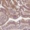 X-Linked Inhibitor Of Apoptosis antibody, HPA042428, Atlas Antibodies, Immunohistochemistry paraffin image 