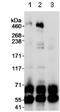 E1A-binding protein p400 antibody, ab70301, Abcam, Immunoprecipitation image 