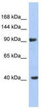Potassium Voltage-Gated Channel Subfamily H Member 6 antibody, TA338764, Origene, Western Blot image 