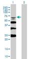 RecQ Mediated Genome Instability 1 antibody, H00080010-B02P, Novus Biologicals, Western Blot image 
