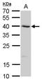 Serpin Family B Member 8 antibody, GTX117950, GeneTex, Western Blot image 