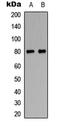 Microtubule Associated Protein Tau antibody, LS-C358814, Lifespan Biosciences, Western Blot image 