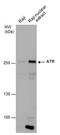 ATR Serine/Threonine Kinase antibody, MA1-23158, Invitrogen Antibodies, Western Blot image 