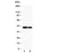 Gap Junction Protein Alpha 5 antibody, R30437, NSJ Bioreagents, Western Blot image 
