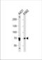 Prostaglandin G/H synthase 1 antibody, TA324737, Origene, Western Blot image 