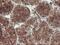 U-Box Domain Containing 5 antibody, M12899, Boster Biological Technology, Immunohistochemistry paraffin image 