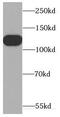 Cell Division Cycle Associated 2 antibody, FNab01539, FineTest, Western Blot image 