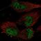 TatD DNase Domain Containing 1 antibody, NBP2-55666, Novus Biologicals, Immunocytochemistry image 