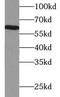 Beta-N-acetylhexosaminidase subunit beta antibody, FNab03844, FineTest, Western Blot image 