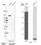 Huntingtin Interacting Protein 1 antibody, HPA013606, Atlas Antibodies, Western Blot image 
