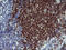 CD22 Molecule antibody, M01572-4, Boster Biological Technology, Immunohistochemistry paraffin image 