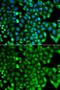 HLA class II histocompatibility antigen, DRB1-15 beta chain antibody, GTX55662, GeneTex, Immunofluorescence image 