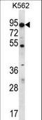 ATP Binding Cassette Subfamily D Member 2 antibody, LS-C155855, Lifespan Biosciences, Western Blot image 