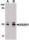 N-Acylsphingosine Amidohydrolase 1 antibody, PA5-20574, Invitrogen Antibodies, Western Blot image 