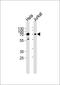 Serine/threonine-protein kinase PAK 3 antibody, MBS9209950, MyBioSource, Western Blot image 