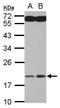 Myosin regulatory light chain 2, atrial isoform antibody, GTX116713, GeneTex, Western Blot image 