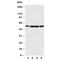 Fascin Actin-Bundling Protein 1 antibody, R30651, NSJ Bioreagents, Western Blot image 