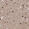 Seizure protein 6 antibody, NBP1-90945, Novus Biologicals, Immunohistochemistry frozen image 