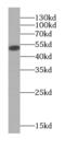 Keratin 7 antibody, FNab02220, FineTest, Western Blot image 