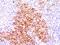 TNF Receptor Superfamily Member 8 antibody, MBS438329, MyBioSource, Immunohistochemistry paraffin image 