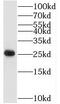 TATA-Box Binding Protein Associated Factor 9 antibody, FNab08489, FineTest, Western Blot image 