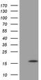 Mitochondrial Ribosomal Protein L27 antibody, M08541, Boster Biological Technology, Western Blot image 